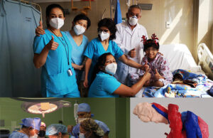 Exitosa operación se realizó en el INSN Breña con tecnología 3D salvan vida a niña con tumor en el páncreas