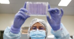 Primer Congreso médico «Long Covid» se realizará del 16 al 18 de marzo en Perú