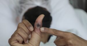 INS: Perú logra aprobar con éxito el procedimiento para diagnóstico del virus de la viruela del mono