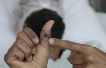 INS: Perú logra aprobar con éxito el procedimiento para diagnóstico del virus de la viruela del mono