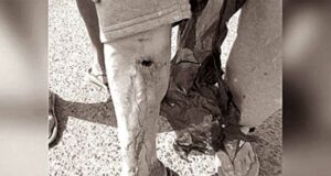 Perro pitbull ataca a adulto mayor