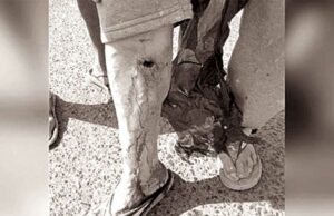 Perro pitbull ataca a adulto mayor