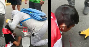 Puno: ¡URGENTE! 5 heridos por perdigones | Uno con graves heridas en la cabeza Puno: ¡URGENTE! 5 heridos por perdigones | Uno con graves heridas en la cabeza