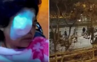 Mujer pierde ojo derecho al ser alcanzada por piedra en pelea entre barristas de Universitario