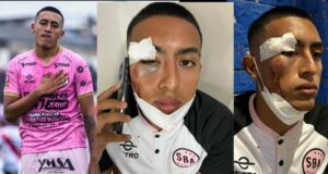 Fabrizio Roca, jugador de Sport Boys, fue atacado brutalmente por barristas de Sporting Cristal