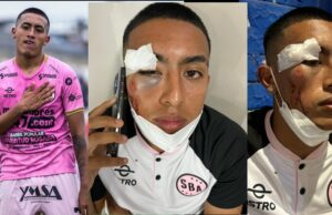 Fabrizio Roca, jugador de Sport Boys, fue atacado brutalmente por barristas de Sporting Cristal