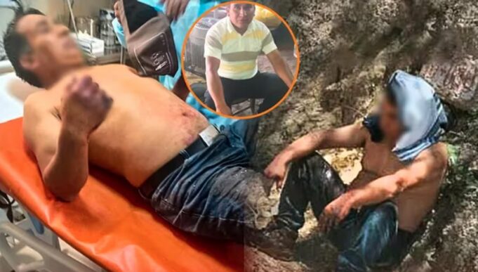 Secuestro Cajamarca: liberan a comerciante que sufrió amputación de tres dedos por parte de los delincuentes (VIDEO)