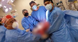 Cirujanos del Hospital Nacional PNP «Luis N. Saéz» extirpan tumor de 35 kilos y salvan vida a esposa de Policía