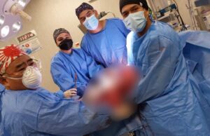 Cirujanos del Hospital Nacional PNP «Luis N. Saéz» extirpan tumor de 35 kilos y salvan vida a esposa de Policía