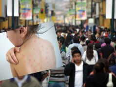 Lima en peligro por el Virus de Sarampión: “Una sola persona puede infectar a 18 a la vez”