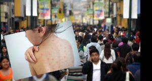 Lima en peligro por el Virus de Sarampión: “Una sola persona puede infectar a 18 a la vez”