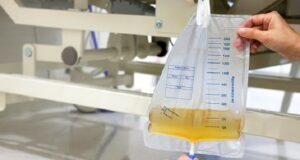 Homologarán bolsa recolectora de orina para facilitar su compra en el Estado en beneficio de pacientes renales