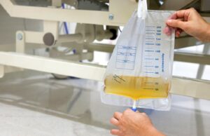 Homologarán bolsa recolectora de orina para facilitar su compra en el Estado en beneficio de pacientes renales