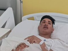 Valiente policía de tránsito que fue atropellado en el Callao viene siendo atendido en el Hospital Nacional PNP «Luis N. Sáenz»