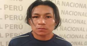 Callao: Poder Judicial dictó 9 meses de prisión preventiva contra agresor que mordió y arrancó la nariz a su ex pareja