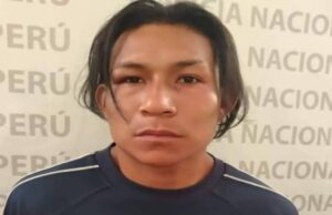 Callao: Poder Judicial dictó 9 meses de prisión preventiva contra agresor que mordió y arrancó la nariz a su ex pareja