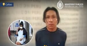 Callao: Ministerio Público solicita nueve meses de prisión preventiva para sujeto que arrancó la nariz a su ex pareja