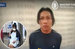 Callao: Ministerio Público solicita nueve meses de prisión preventiva para sujeto que arrancó la nariz a su ex pareja