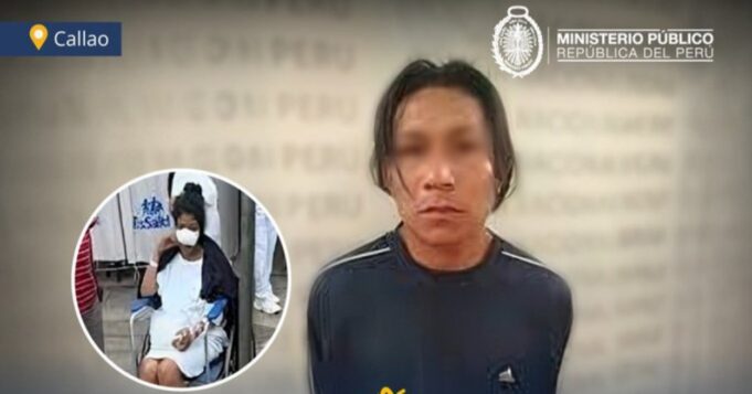 Callao: Ministerio Público solicita nueve meses de prisión preventiva para sujeto que arrancó la nariz a su ex pareja