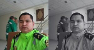 Policía herido en balacera en San Borja: Sigue en UCI, descartan daño en el cerebro, pero tiene la cara fracturada y la visión comprometida