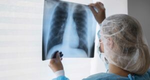 Niños representan cerca del 7% de cáncer por sarcoma