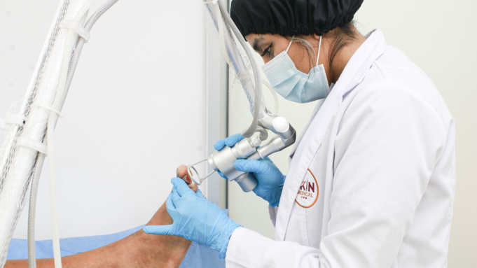 El Avance Médico que Todo Paciente Diabético Debe Conocer: RegenerisLaser