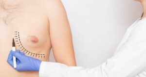 Con técnica de fibra óptica dicen adiós al llamado“pecho masculino”