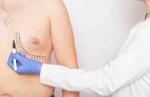 Con técnica de fibra óptica dicen adiós al llamado“pecho masculino”