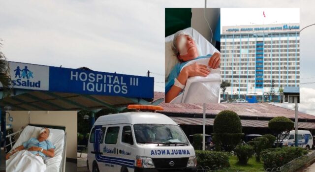 Sacaojos en EsSalud: Extirpan ojos a tres pacientes por negligencia médica