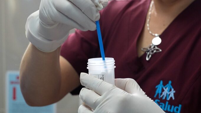 EsSalud Sabogal implementa pruebas moleculares para prevenir el cáncer de cuello uterino