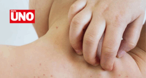 Minsa declara alerta epidemiológica por caso importado de sarampión en niño de 11 años