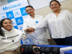 Traumatólogos del hospital Rebagliati de EsSalud logran alargar la pierna de una menor de 12 años con cirugías de alta complejidad