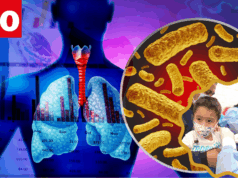 Tos ferina deja 10 muertos y más de 400 casos en Perú