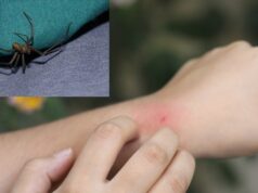 Invierno aumenta riesgo de mordeduras de araña casera, advierte el INS
