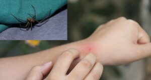 Invierno aumenta riesgo de mordeduras de araña casera, advierte el INS