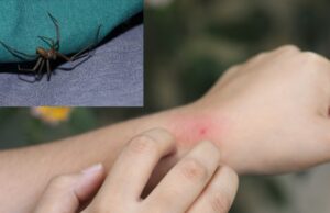 Invierno aumenta riesgo de mordeduras de araña casera, advierte el INS