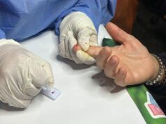 Concientización y prevención: Día Nacional de la Prueba del VIH