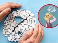 Demencia senil afecta a 57 millones de personas en el mundo