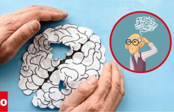 Demencia senil afecta a 57 millones de personas en el mundo