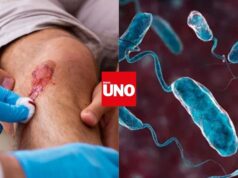 Bacteria come carne en Florida deja 4 muertos y genera alerta