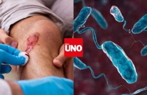 Bacteria come carne en Florida deja 4 muertos y genera alerta