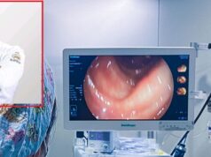 Cáncer de colon: mitos peligrosos que ponen en riesgo tu salud y retrasan el diagnóstico