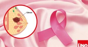 Cáncer de mama sin diagnóstico temprano en Perú