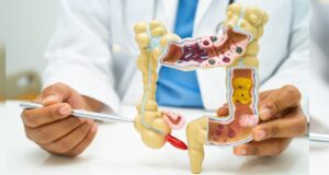 Cáncer de colon: ¿por qué la diarrea o el estreñimiento no deben ignorarse?