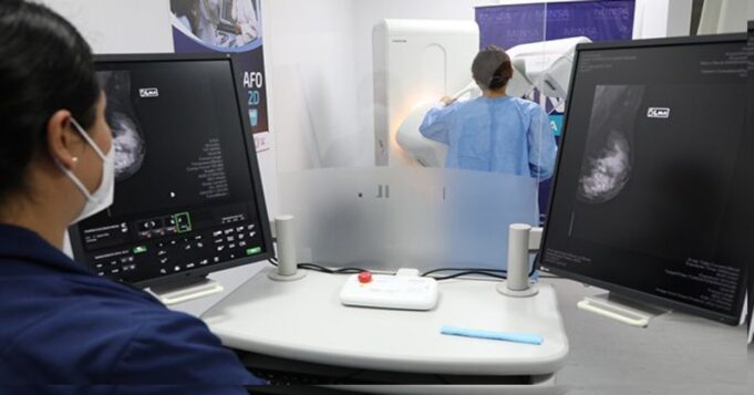 Minsa: mamografías se quintuplicaron en comparación a años anteriores