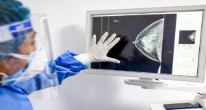 ¿Por qué el cáncer hace metástasis? El proceso detrás de la expansión tumoral