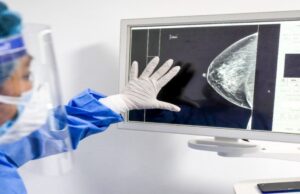 ¿Por qué el cáncer hace metástasis? El proceso detrás de la expansión tumoral