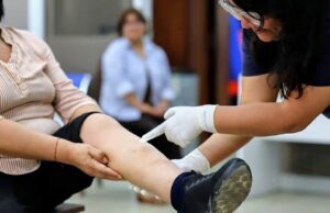 Cuidado con las várices