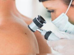 Hospitales del Minsa, Essalud , FF. AA. policiales y clínicas participarán en la campaña nacional “El Día del Lunar”