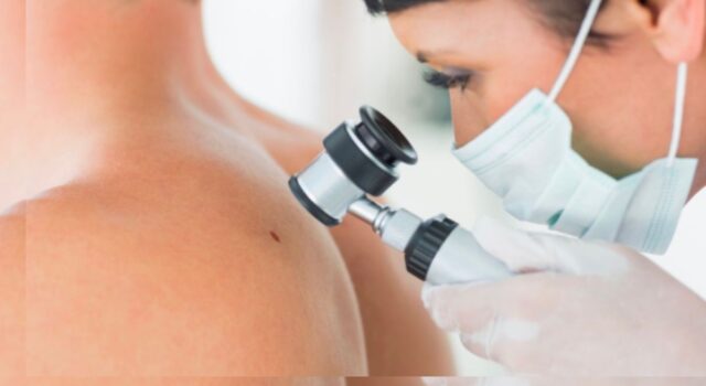 Hospitales del Minsa, Essalud , FF. AA. policiales y clínicas participarán en la campaña nacional “El Día del Lunar”